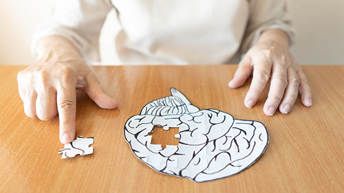 The Three Major Alzheimer’s Disease Stages with Brief Description - Gainesville, GA